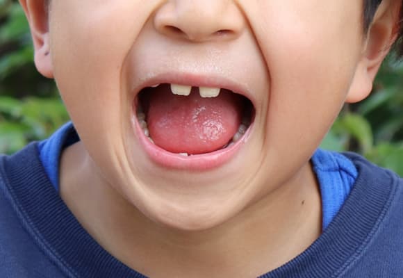 子どもの舌